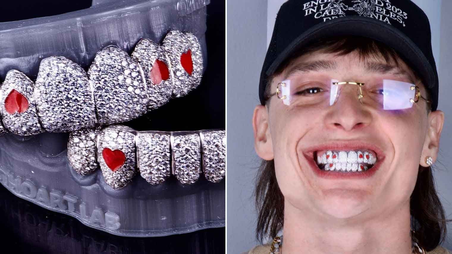 Peso Pluma: ¿Cuánto Cuesta Su Nueva Dentadura de Diamantes?