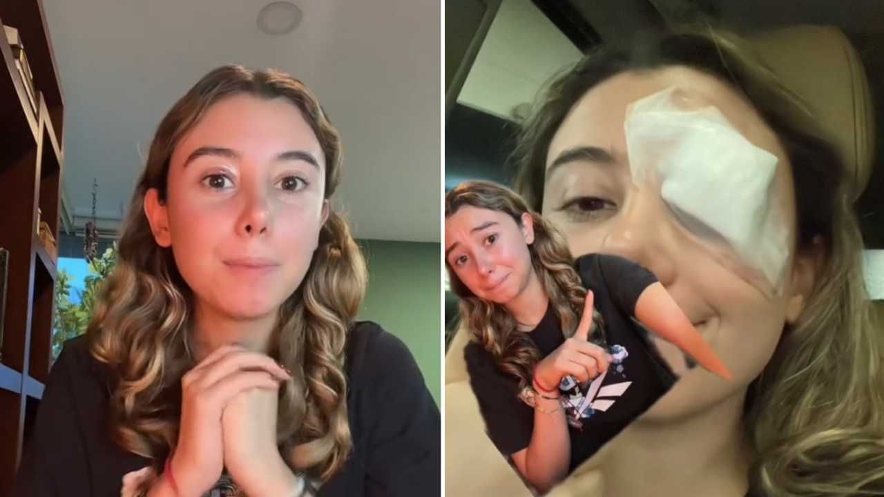 Operan a joven del ojo por seguir consejo de belleza de TikTok