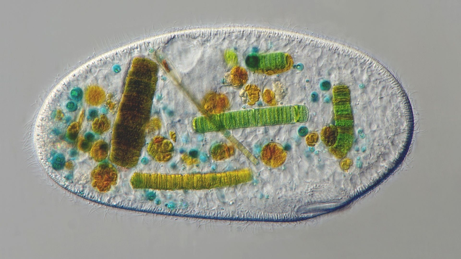 Protozoario comiendo una cianobacteria