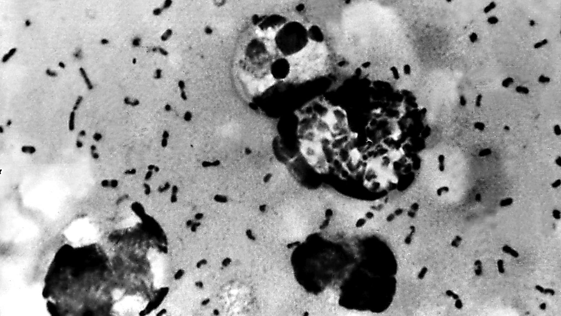 Imagen de la bacteria de la peste bubónica extraída de un paciente