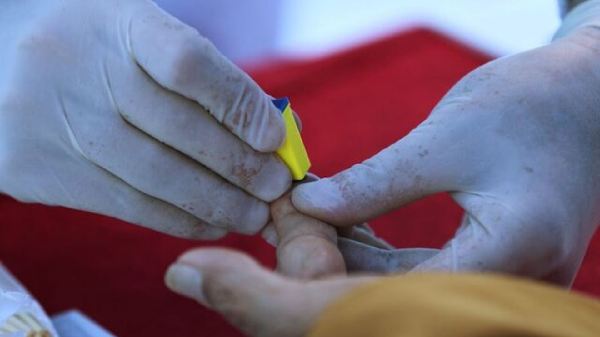 Trabajadores de salud realizan prueba de VIH